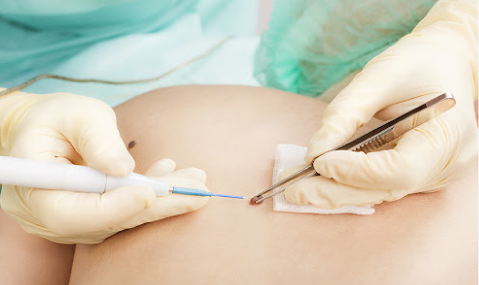 Dermatologista no paraiso sp