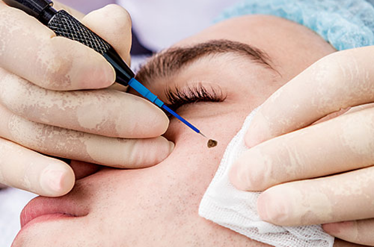 Dermatologista no paraiso sp