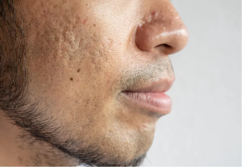 Dermatologista no paraiso sp