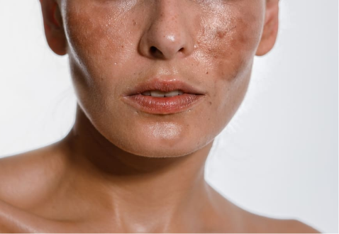 Dermatologista no paraiso sp