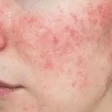 Dermatologista no paraiso sp