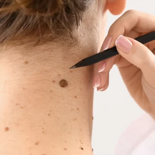 Dermatologista no paraiso sp